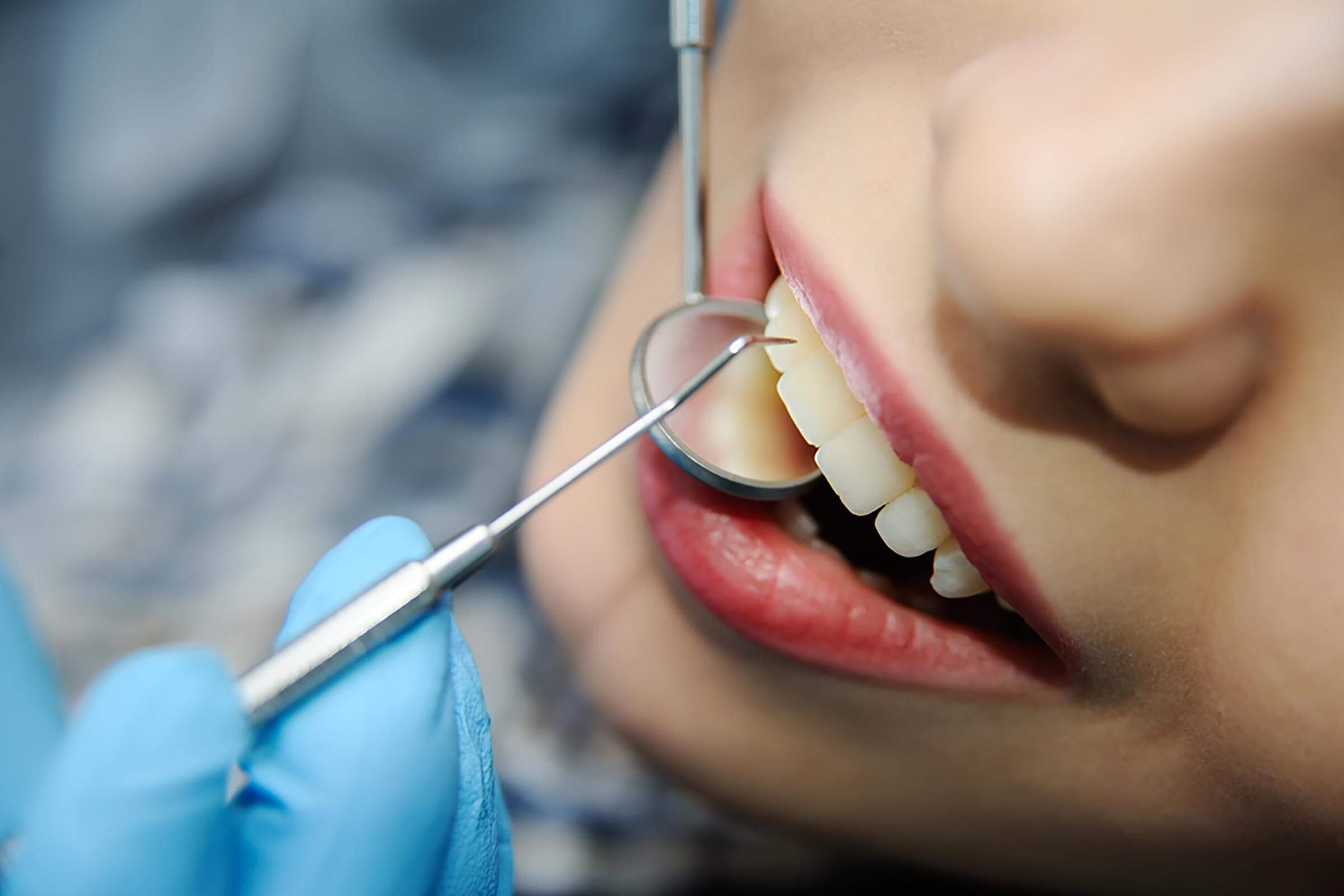 dental implants in Delhi