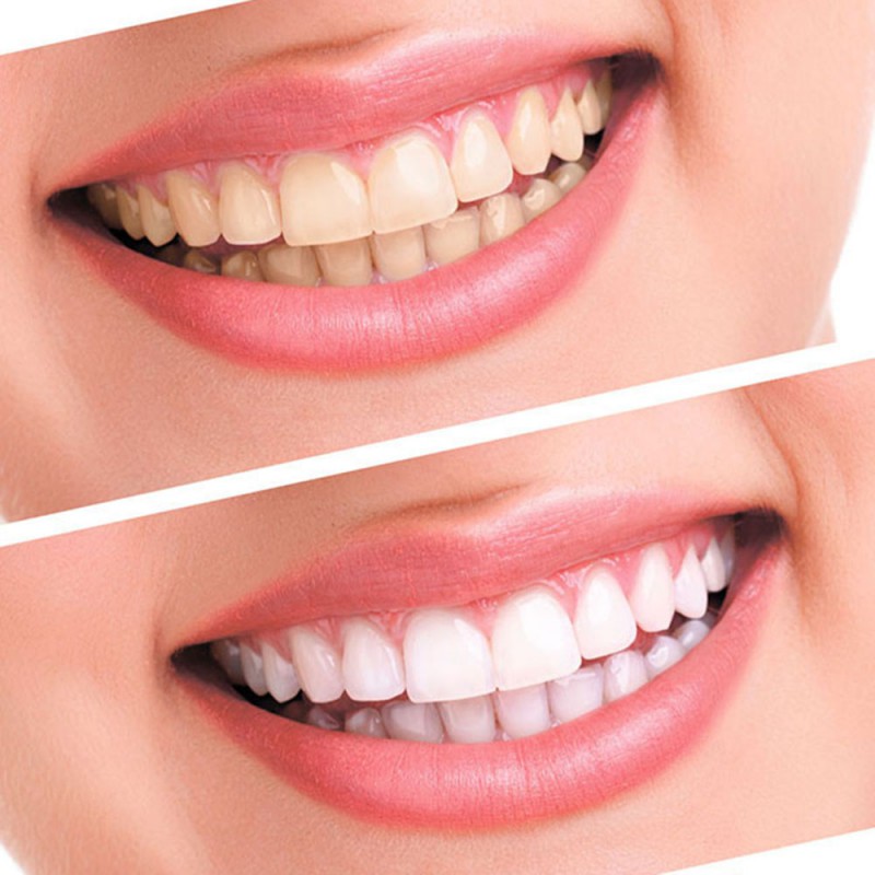 best dentist in Delhi