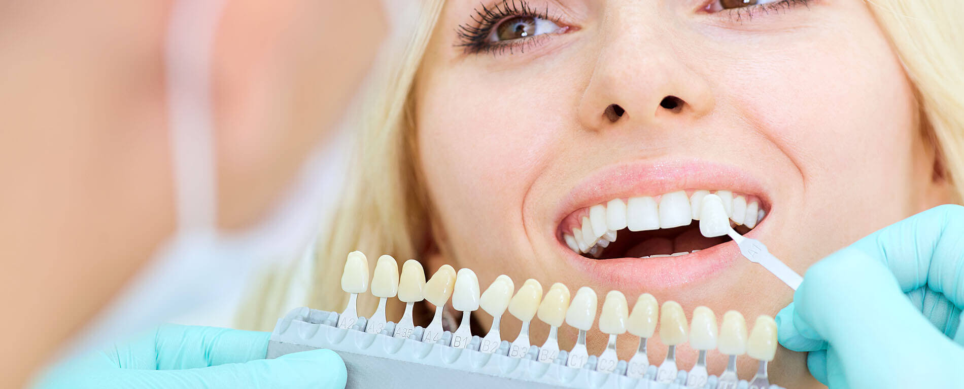 teeth whitening treatment dentist