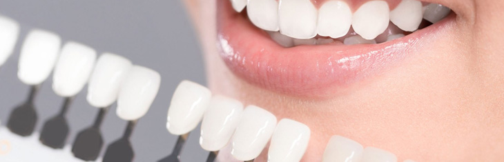 teeth whitening